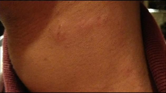 Teenager arrested for choking former classmate at Miami Gardens high school