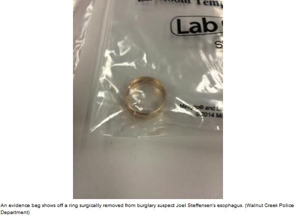 Police: Man swallows stolen ring, needs surgery to remove it