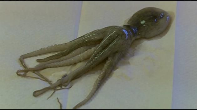 Police: Kansas boy found with octopus in throat improves