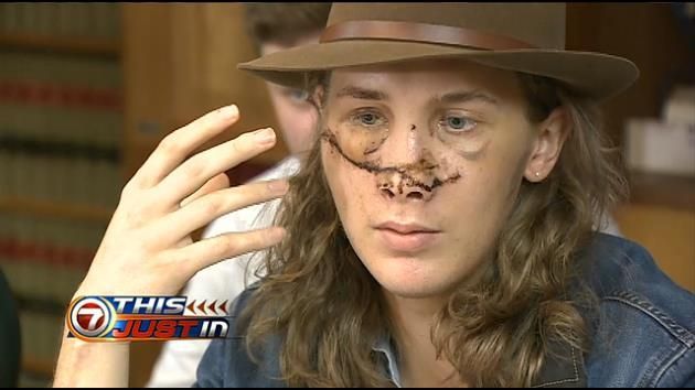 Man injured by road debris speaks out about injuries