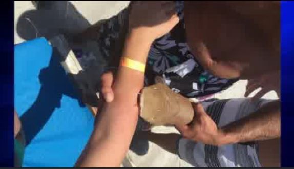 Woman taken to hospital with shark still attached to her arm