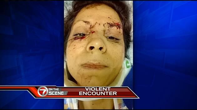 Man shot, woman pistol-whipped by Miami home invader