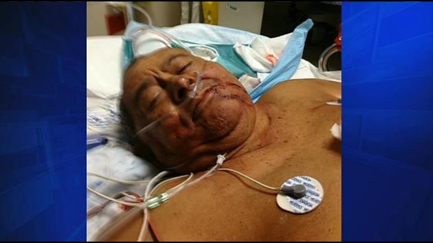 Wife of elderly hit-and-run victim asks for public's help
