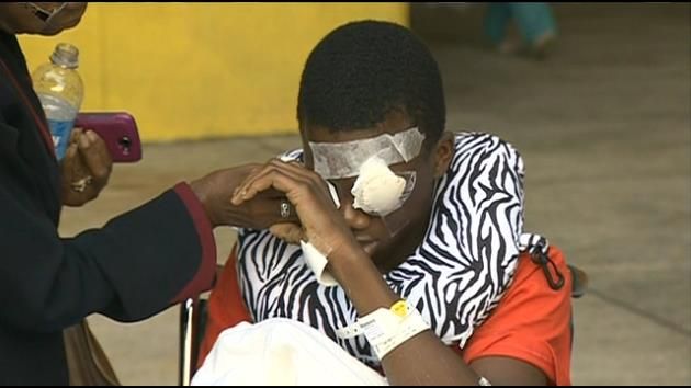 South Florida teen injured by firework returns home