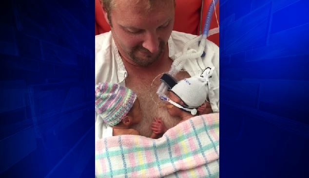 Preemie twins can't stop holding hands in heartwarming viral video